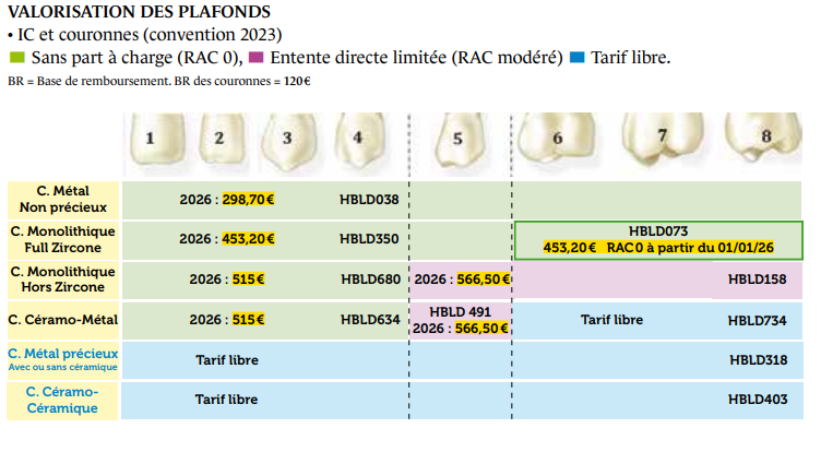 Valorisation couronnes Union Dentaire
