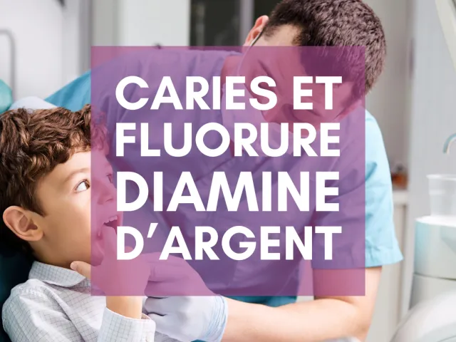 Caries et Fluorure Diamine d’Argent (FDA)